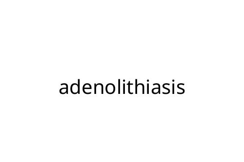 adenolithiasis